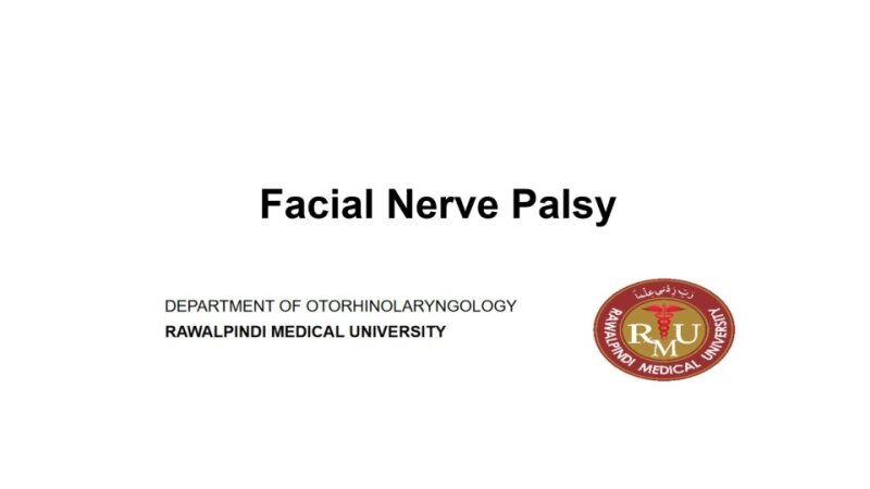 Facial-Nerve-Palsy.pptx