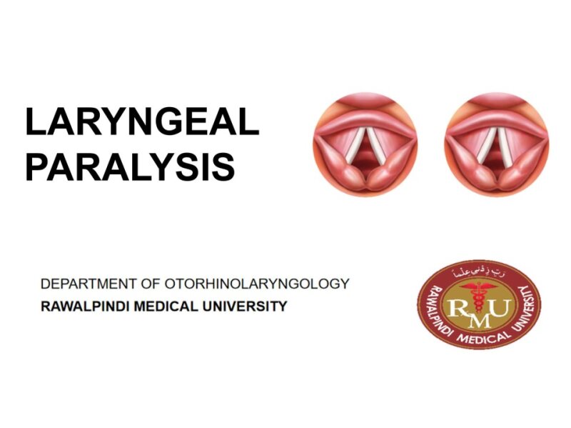 laryngeal-paralysis-.pptx