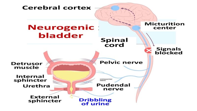3-Neurogenic-bladder-patient-dignity-confidentiality-18-9-24.pptx