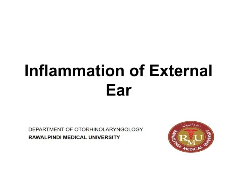 Diseases-of-External-Ear-.pptx