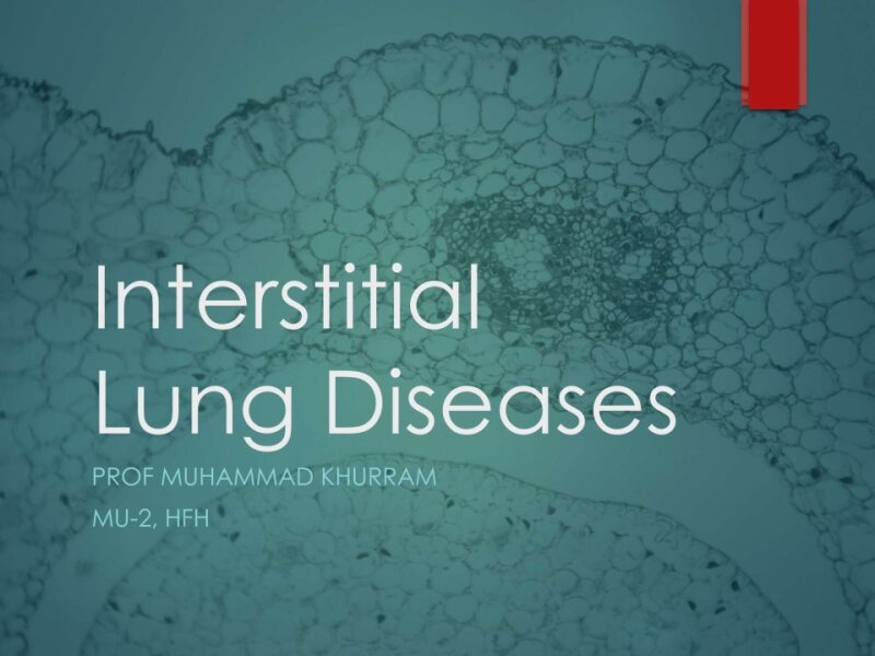 ILD-Presentation.pptx