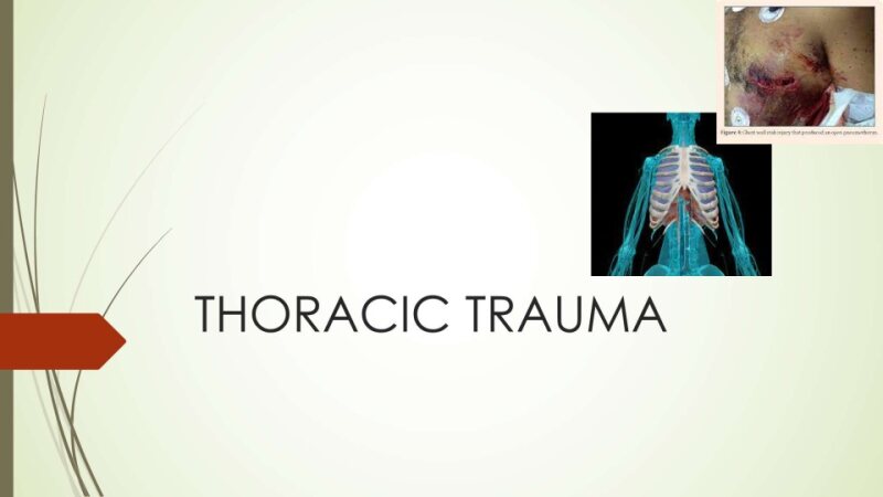 THORACIC-TRAUMA.pptx