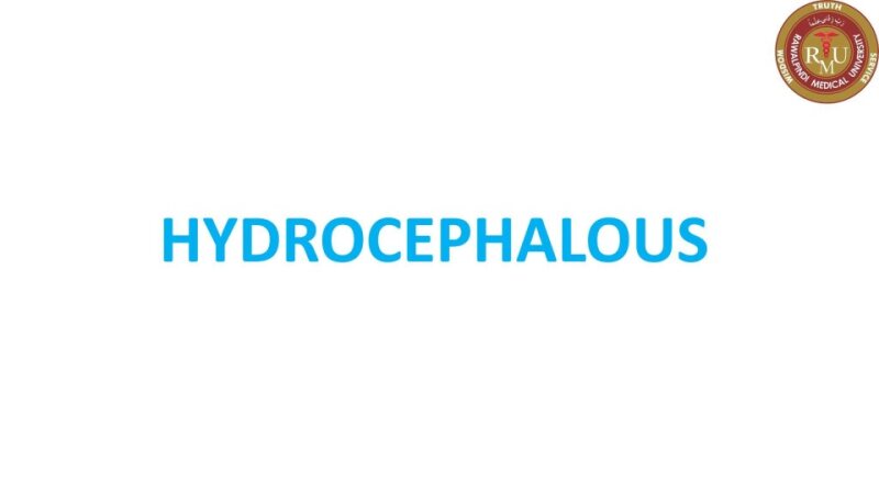 hydrocephalus.pptx