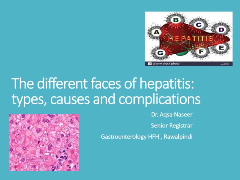 3RD-YR-Lecture-hepatitis-cirrhosis-dr.-aqsa.pptx