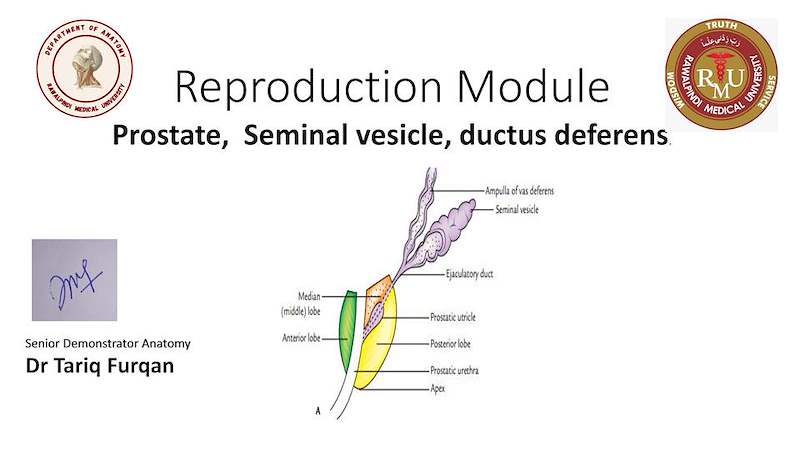 prostate ,seminal vesicle.pdf