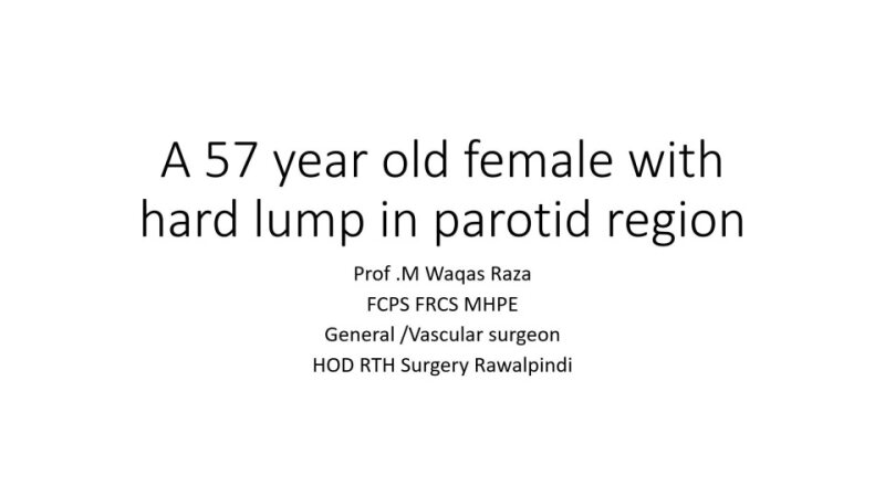 A-57-year-old-female-with-hard-lump.pptx