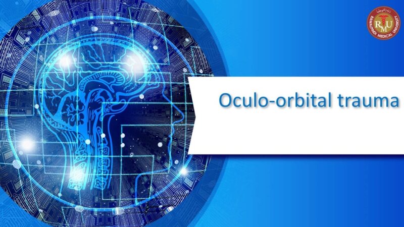 OculoOrbital-Trauma.-Final-1.pptx