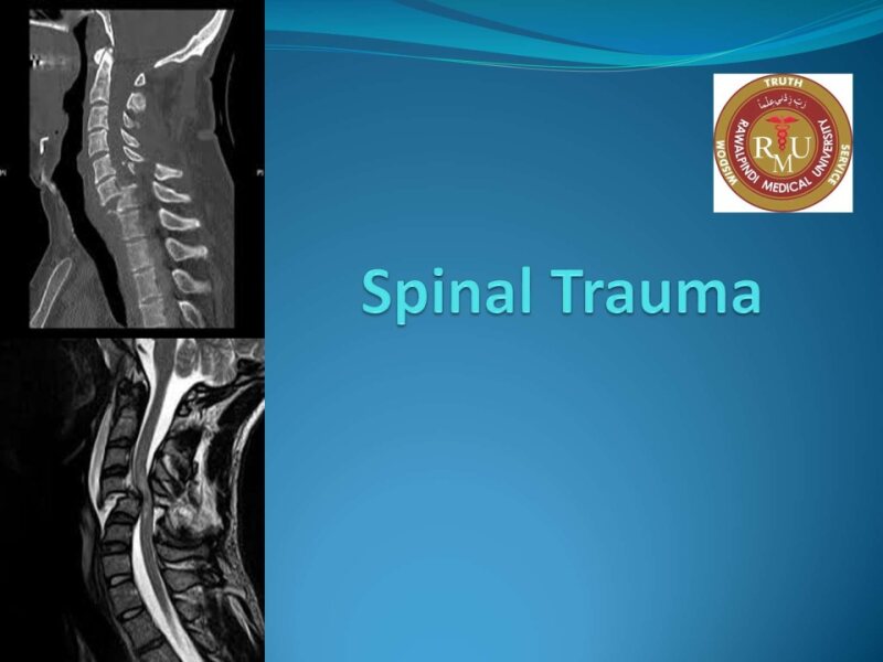 Spinal-Trauma-2.pptx