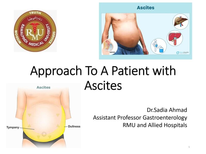 Approach-To-A-Patient-with-Ascites-3-Copy.pptx