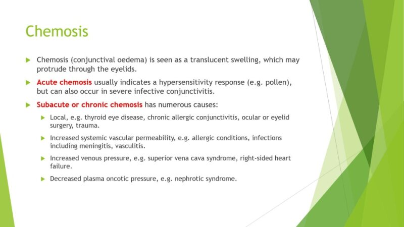 Conjunctivitis-2-1.pptx