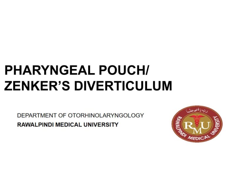 pharyngeal-pouch-and-laryngocele.pptx