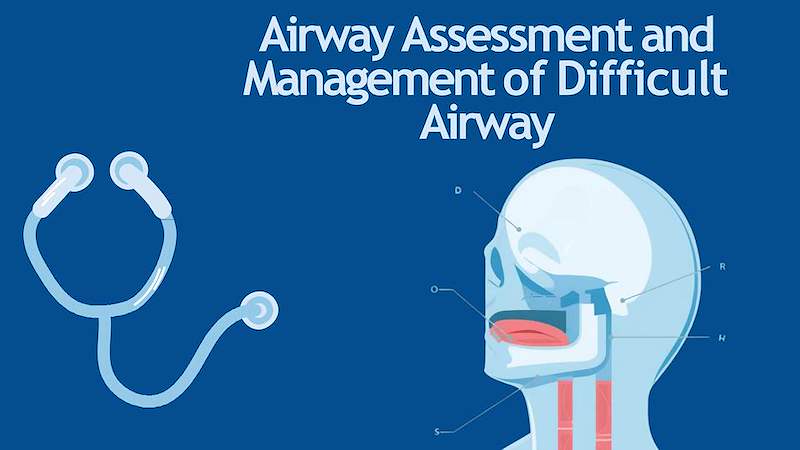 F Airway Assessment & Difficult Airway Management_20260610_191837_0000 copy copy.pdf