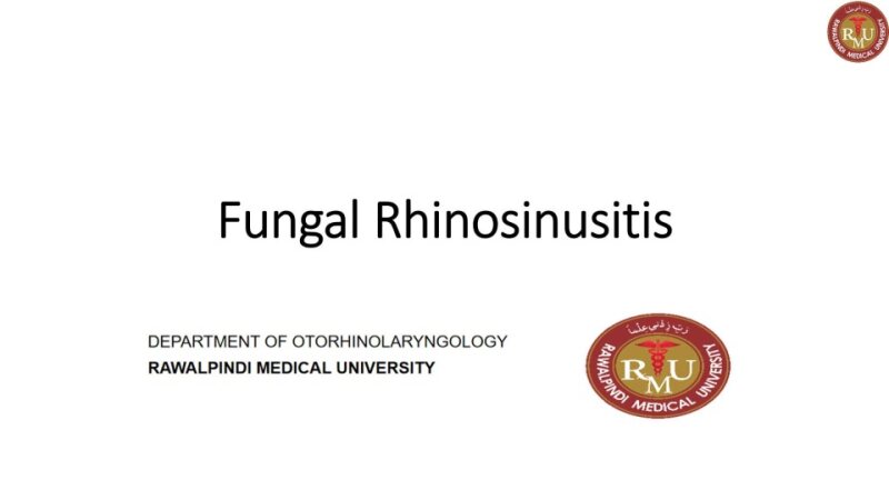 Fungal-rhinosinusitis.pptx