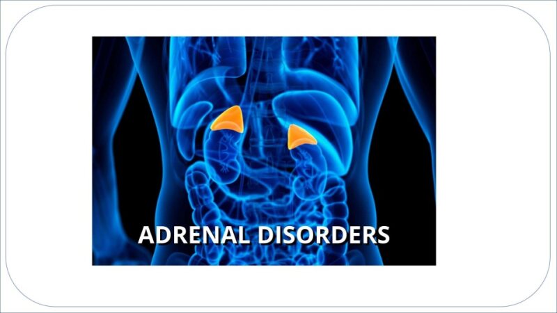 adrenal-disorders.pptx