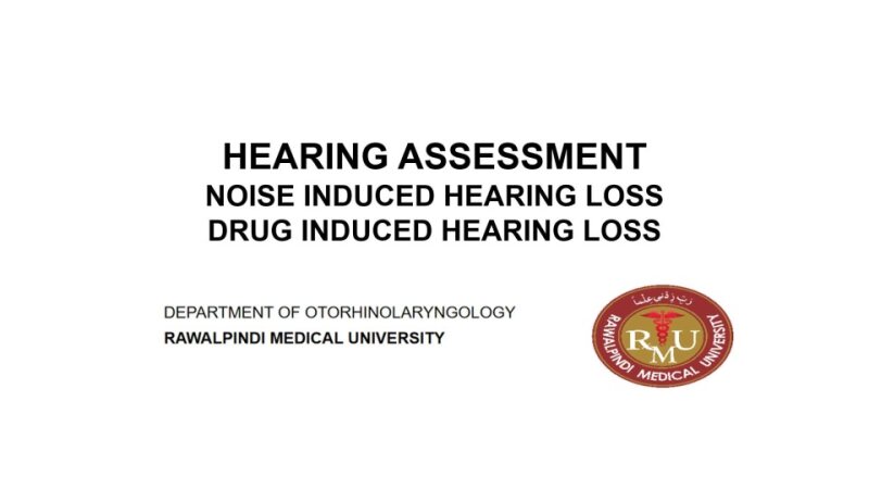 Hearing-assessmentSNHLNIHL.pptx
