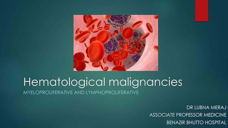 2) hematological malignancies.pptx