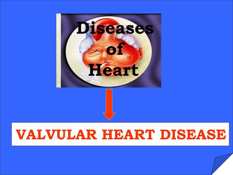 valvular-Heart-Disease.pptx