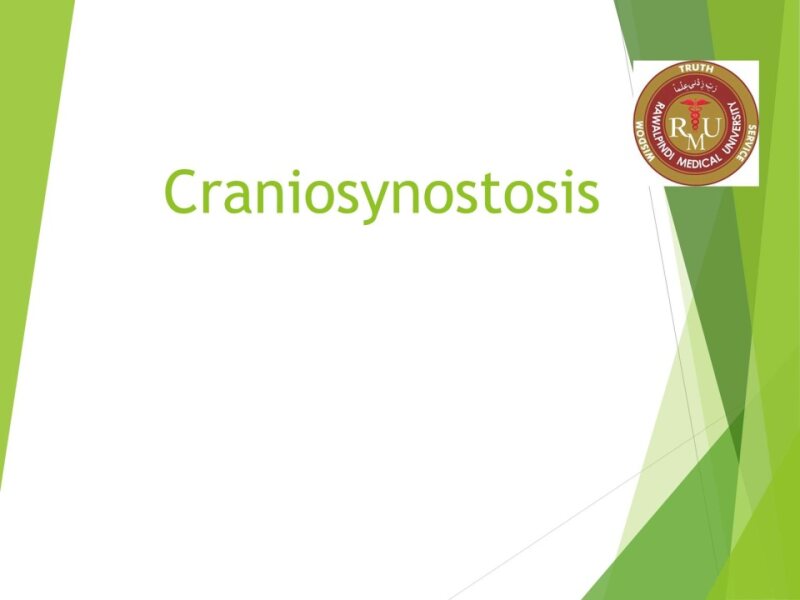 Craniosynostosis.pptx