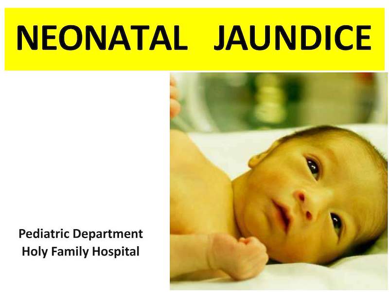 NEONATAL JAUNDICE 2025.pdf
