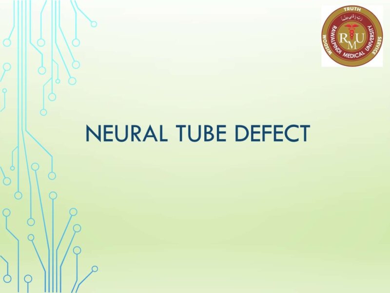 neural-tube-defects.pptx