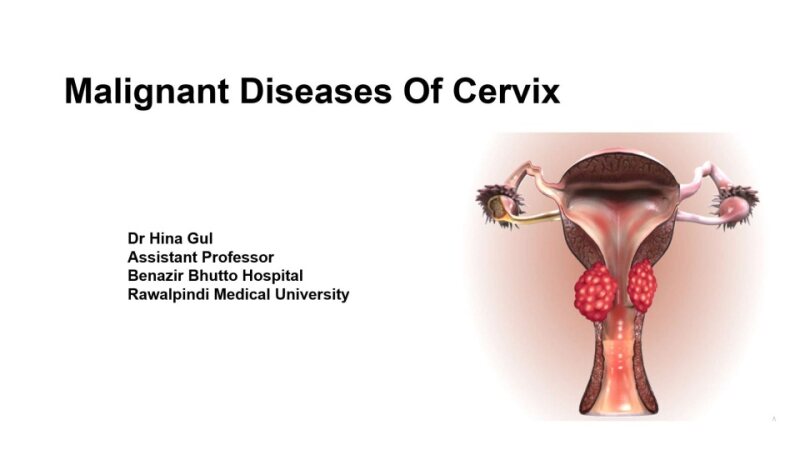 Final-malignant-disease-cervix.pptx