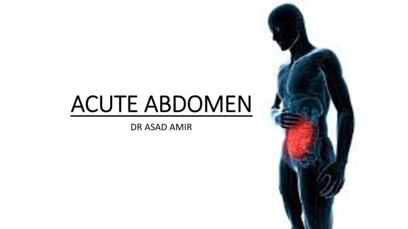 ACUTE-ABDOMEN.pptx