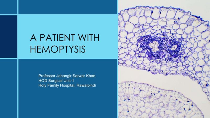 CARCINOMA-LUNG.ppt