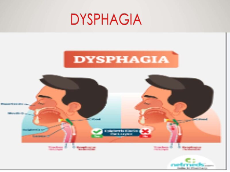 final-year-dysphagia-lecture.pptx