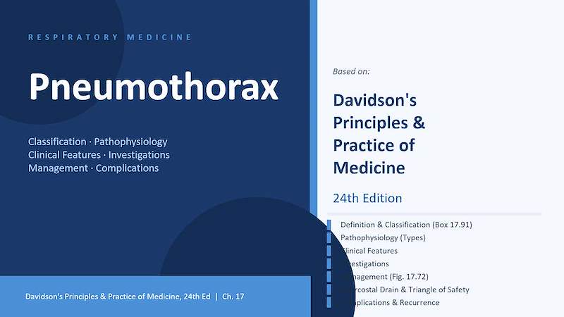 Pneumothorax.pptx