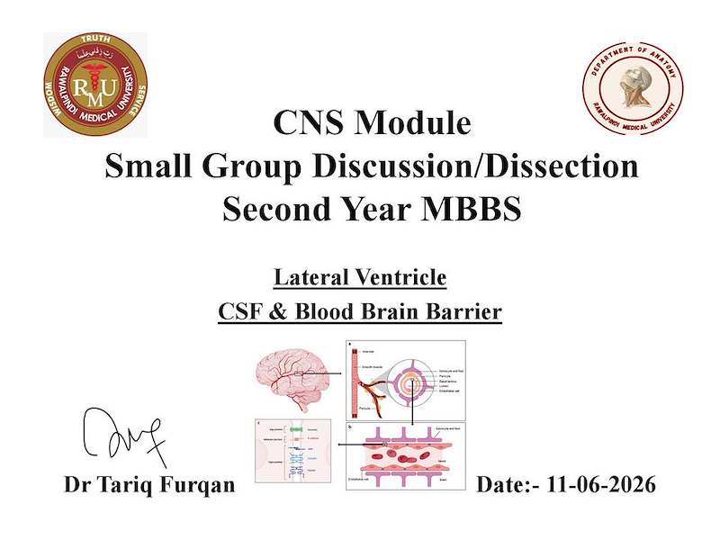 13 LATERAL VENTRICLE.pdf