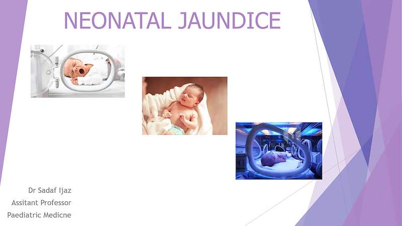 NEONATAL JAUNDICE BY Dr Sadaf.pptx
