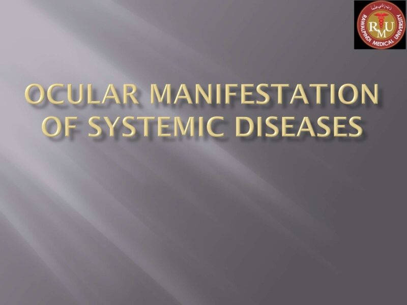 SYSTEMIC-DISEASES-IN-OPHTHALMOLOGY-1-1-2-1.pptx