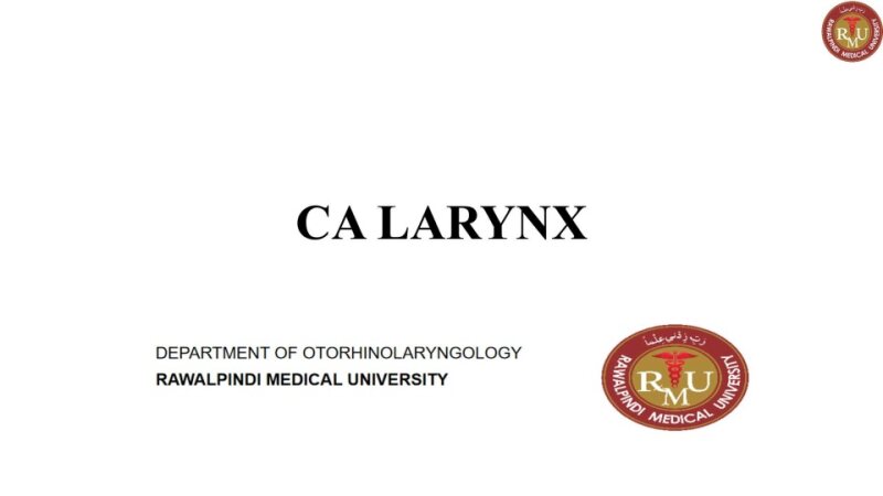 CA-Larynx.pptx