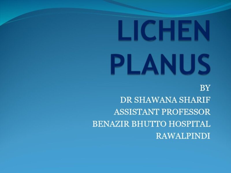 Lichen-Planus-P.pdf