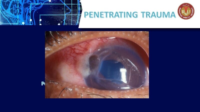 Penetrating-Trauma-1.pdf
