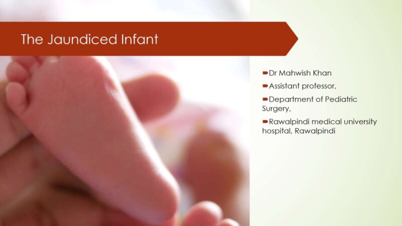 jaundiced-infant.pptx