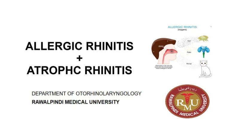 Allergic-Rhinitis-atrophic-rhinitis.pptx
