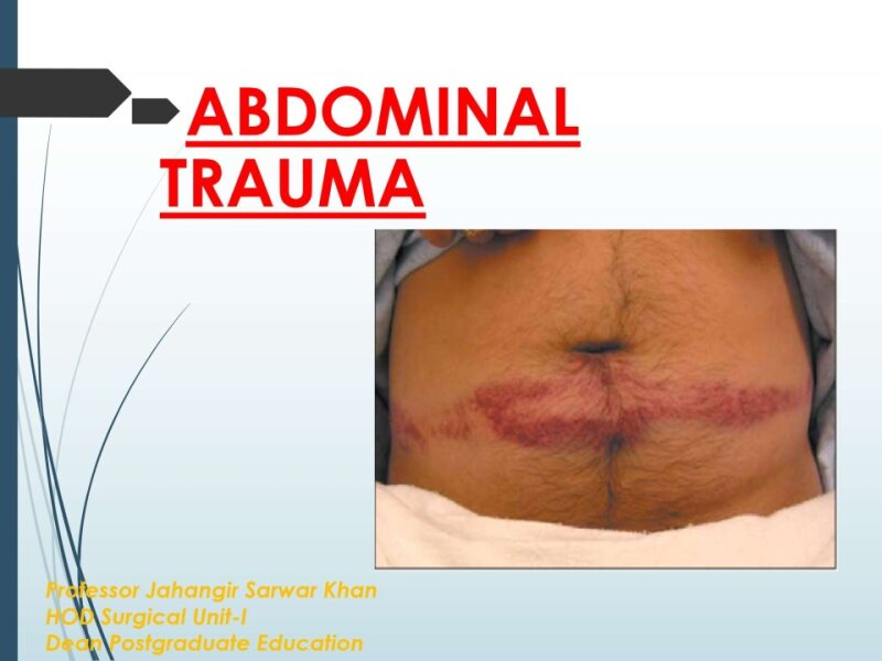 trauma for final year without video.pptx