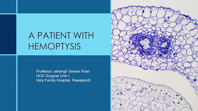 CARCINOMA LUNG.ppt