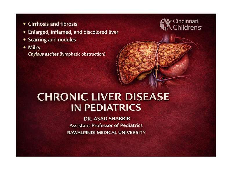 CHRONIC LIVER DISEASE DR.ASAD 2026.ppt