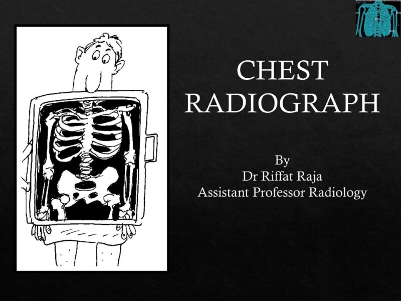 chest-final-year-lecture.pptx